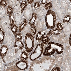ABCC11 Antibody, Novus Biologicals 25 &mu;L, Unlabeled:Antibodies, Polyclonal