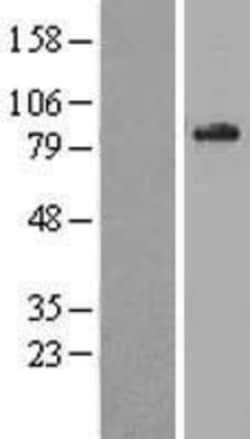 Novus Biologicals™ ABCD1 Overexpression Lysate