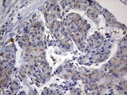 ABCD1 Antibody (OTI2C12), Novus Biologicals 0.1mL; Unlabeled:Antibodies,