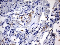 ABCD1 Antibody (OTI2C12), Novus Biologicals 0.1mL; Unlabeled:Antibodies,
