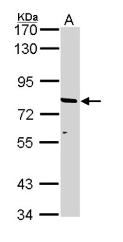 ABCD2 Antibody, Novus Biologicals 0.1mL; Unlabeled:Antibodies, Polyclonal