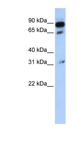 ABCD4 Antibody, Novus Biologicals 100&mu;L; Unlabeled:Antibodies, Polyclonal