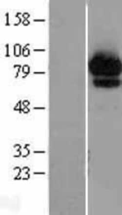 Novus Biologicals&trade;&nbsp;ABCF2 Overexpression Lysate