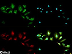 ABCF2 Antibody, Novus Biologicals 0.025mL; Unlabeled:Antibodies, Polyclonal