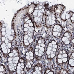 ABCG4 Antibody, Novus Biologicals:Antibodies:Primary Antibodies