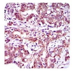 ABCG5 Antibody (1B5E10), Novus Biologicals 0.1mL; Unlabeled:Antibodies,