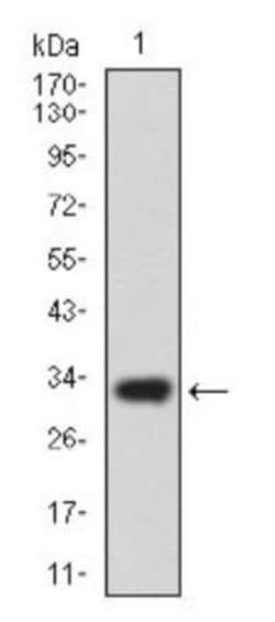 ABCG5 Antibody (1B5E10), Novus Biologicals 0.1mL; Unlabeled:Antibodies,
