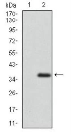 ABCG5 Antibody (1B5E10), Novus Biologicals 0.1mL; Unlabeled:Antibodies,