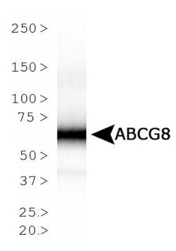ABCG8 Antibody (1B10A5), Novus Biologicals | Buy Online | Novus Biologicals | Fisher Scientific