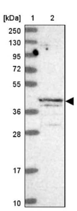 ABH1 Antibody, Novus Biologicals:Antibodies:Primary Antibodies