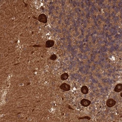ABH1 Antibody, Novus Biologicals:Antibodies:Primary Antibodies