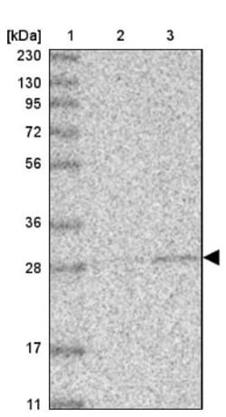 ABHD10 Antibody, Novus Biologicals 25 &mu;L; Unlabeled:Antibodies, Polyclonal