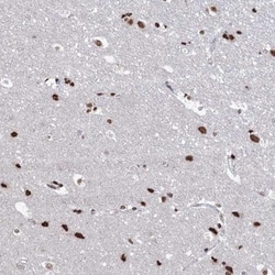 ABHD10 Antibody, Novus Biologicals 0.1mL; Unlabeled:Antibodies, Polyclonal