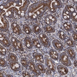 ABHD10 Antibody, Novus Biologicals 25 &mu;L; Unlabeled:Antibodies, Polyclonal