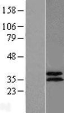 Novus Biologicals™ ABHD11 Overexpression Lysate