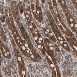 ABHD11 Antibody, Novus Biologicals:Antibodies:Primary Antibodies