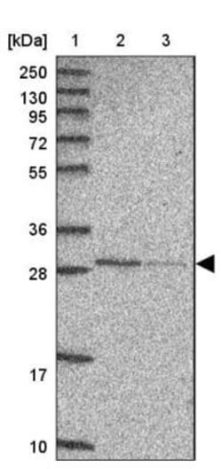 ABHD11 Antibody, Novus Biologicals 0.1mL; Unlabeled:Antibodies, Polyclonal