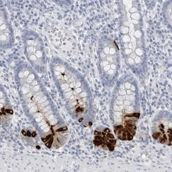 ABHD12 Antibody, Novus Biologicals 0.1mL; Unlabeled:Antibodies, Polyclonal