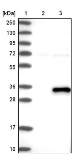 ABHD12B Antibody, Novus Biologicals 0.1mL; Unlabeled:Antibodies, Polyclonal