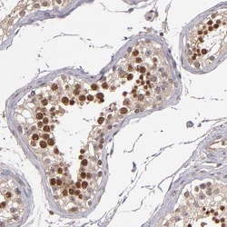 ABHD12B Antibody, Novus Biologicals 0.1mL; Unlabeled:Antibodies, Polyclonal