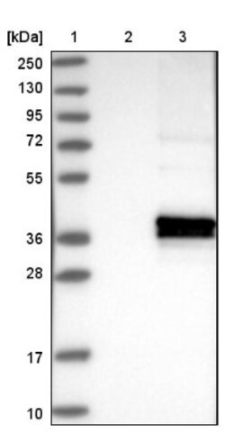 ABHD13 Antibody, Novus Biologicals 0.1 mL | Buy Online | Novus Biologicals | Fisher Scientific