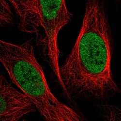 ABHD13 Antibody, Novus Biologicals 0.1 mL | Buy Online | Novus Biologicals | Fisher Scientific