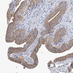 ABHD13 Antibody, Novus Biologicals 0.1 mL | Buy Online | Novus Biologicals | Fisher Scientific