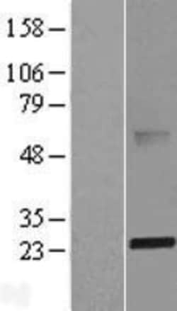 Novus Biologicals&trade;&nbsp;ABHD14B Overexpression Lysate