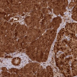 ABHD14B Antibody, Novus Biologicals:Antibodies:Primary Antibodies