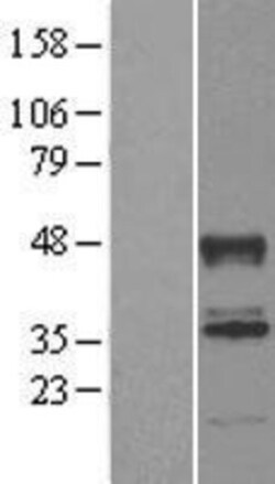 Novus Biologicals™ ABHD2 Overexpression Lysate