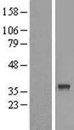 Novus Biologicals&trade;&nbsp;ABHD6 Overexpression Lysate