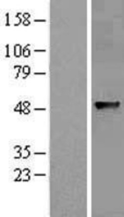 Novus Biologicals™ ABHD8 Overexpression Lysate