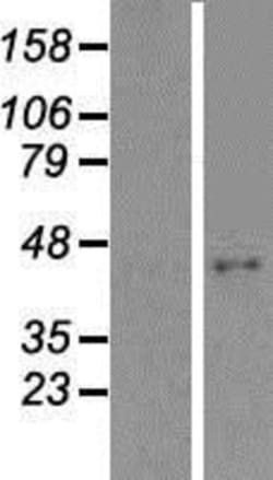Novus Biologicals™ ABHD9 Overexpression Lysate