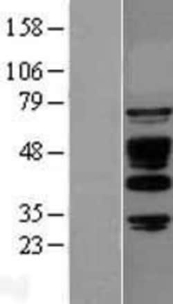 Novus Biologicals ABI1 Overexpression Lysate 0.1 mg | Buy Online | Novus Biologicals&trade; | Fisher Scientific