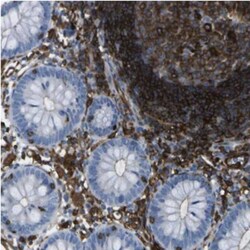 ABI3 Antibody, Novus Biologicals 0.1mL; Unlabeled:Antibodies, Polyclonal