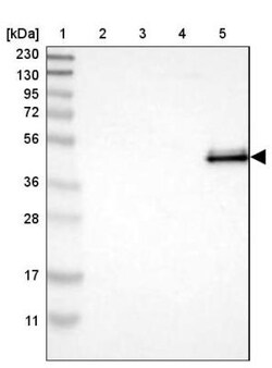 ABI3 Antibody, Novus Biologicals 0.1mL; Unlabeled:Antibodies, Polyclonal