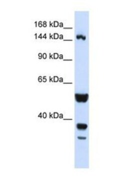 TARSH Antibody, Novus Biologicals 0.05mg; Unlabeled:Antibodies, Polyclonal