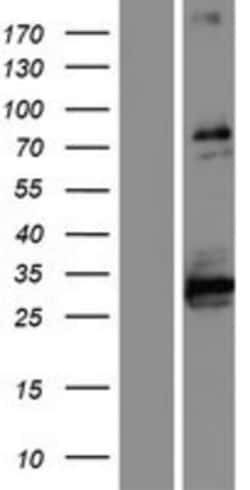 Novus Biologicals™ ABLIM1 Overexpression Lysate