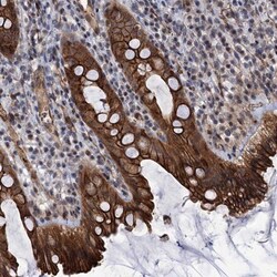 ABLIM1 Antibody, Novus Biologicals 25 &mu;L | Buy Online | Novus Biologicals | Fisher Scientific
