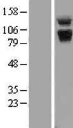 Novus Biologicals&trade;&nbsp;ABR Overexpression Lysate