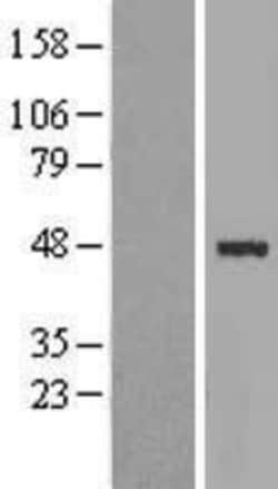 Novus Biologicals&trade;&nbsp;ABRA Overexpression Lysate