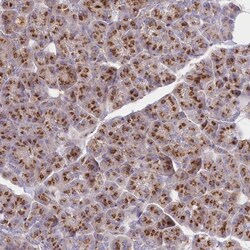ABRO Antibody, Novus Biologicals:Antibodies:Primary Antibodies