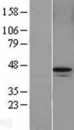 Novus Biologicals&trade;&nbsp;ABRO Overexpression Lysate