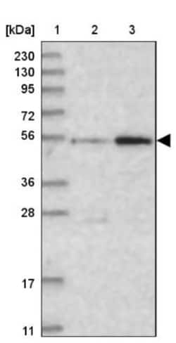 ABRO Antibody, Novus Biologicals:Antibodies:Primary Antibodies