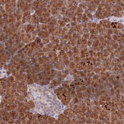 Absent in melanoma 1 Antibody, Novus Biologicals 25 &mu;L, Unlabeled:Antibodies,