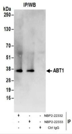 ABT1 Antibody, Novus Biologicals 0.1mg; Unlabeled:Antibodies, Polyclonal