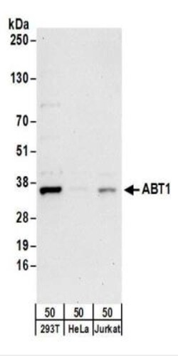ABT1 Antibody, Novus Biologicals 0.1mg; Unlabeled:Antibodies, Polyclonal