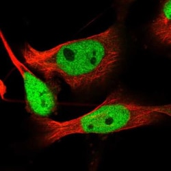 DSS1 Antibody, Novus Biologicals 0.1mL; Unlabeled:Antibodies, Polyclonal