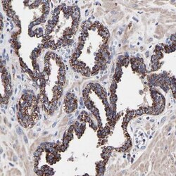 DSS1 Antibody, Novus Biologicals 0.1mL; Unlabeled:Antibodies, Polyclonal