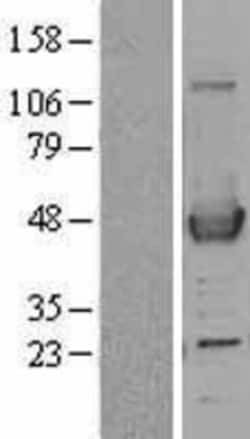 Novus Biologicals™ ACAA1 Overexpression Lysate